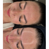 LACTIC BRIGHTENING PEEL 40%, рН 2,9. Всесезонний молочний пілінг для чутливої ​​шкіри, 50 мл
