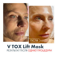 V TOX LIFT MASK. Ультраактивна маска для безін'єкційного ниткового ліфтингу з 11-ма Пептидами та 6-ма видами Колагену. Інноваційна рідка формула з трансформацією на шкірі: висихання, глянцевий каркас, сильний ліфтинговий натяг, 100 мл