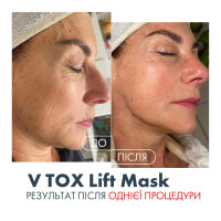 V TOX LIFT MASK. Ультраактивна маска для безін'єкційного ниткового ліфтингу з 11-ма Пептидами та 6-ма видами Колагену. Інноваційна рідка формула з трансформацією на шкірі: висихання, глянцевий каркас, сильний ліфтинговий натяг, 100 мл