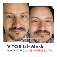 V TOX LIFT MASK. Ультраактивна маска для безін'єкційного ниткового ліфтингу з 11-ма Пептидами та 6-ма видами Колагену. Інноваційна рідка формула з трансформацією на шкірі: висихання, глянцевий каркас, сильний ліфтинговий натяг, 100 мл